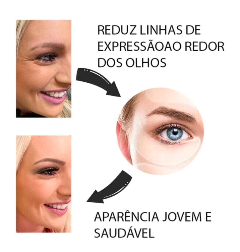 Botox - Livre de rugas e linhas de expressões!